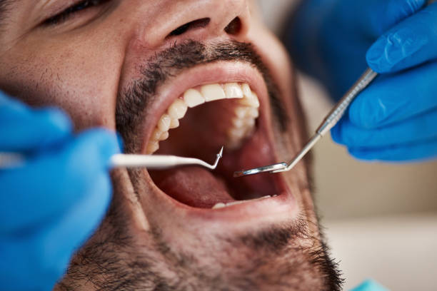 Best Emergency Broken Tooth Repair in Forest Park, IL